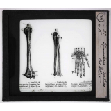 Squelette. Humérus, radius, cubitus.