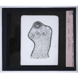 Les Principaux caractères permettant d'appriécier quelques viandes insalubres ou défectueuses. Tête de tænia ou ver solitaire.