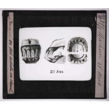 Comment doit-on acheter un cheval ? Mâchoire 21 ans.