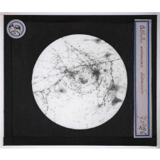 Digestion et circulation. Cellules nerveuses dissociées.