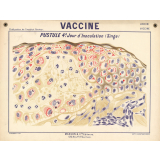 Vaccine. Pustule 4e jour d'inoculation (singe).