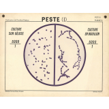 Peste (I). Culture sur gélose. Culture en bouillon.