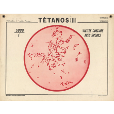 Tétanos (II).