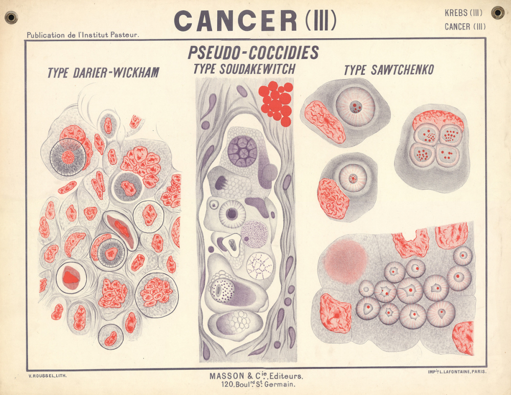 Cancer (III). Pseudo-coccidies.