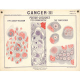 Cancer (III). Pseudo-coccidies.