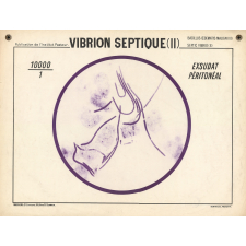 Vibrion septique (II).