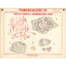 Tuberculose (VII). Bacilles ramifiés. Dégénérescence jaune.