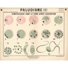 Paludisme (II). Hématozoaire dans le sang après coloration.