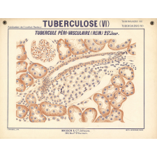 Tuberculose (VI). Tubercule péri-vasculaire (Rein). 25e jour.