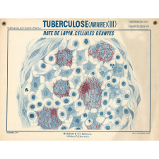 Tuberculose (aviaire) (III). Rate de lapin. Cellules géantes.
