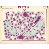 Peste (V). Foie.