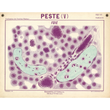 Peste (V). Foie.