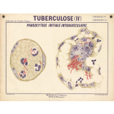 Tuberculose (IV). Phagocytose initiale intravasculaire.
