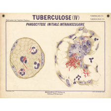 Tuberculose (IV). Phagocytose initiale intravasculaire.