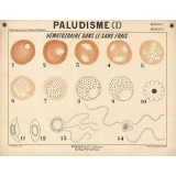 Paludisme (I). Hématozoaire dans le sang frais.