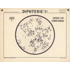 Diphtérie (II).