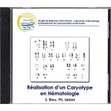 Réalisation d'un Caryotype en Hématologie