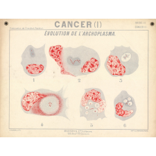Cancer. Evolution de l'archoplasma.