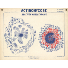 Actinomycose. Réaction phagocytaire.