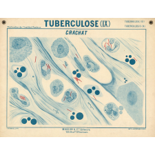 Tuberculose (IX). Crachat.