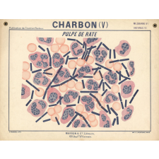 Charbon (V). Pulpe de rate.