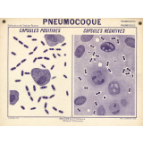Pneumocoque. Capsules positives. Capsules négatives.