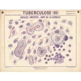 Tuberculose (VIII). Bacilles enkystés. Rate de la gerbille.