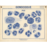 Gonocoque. Pus.