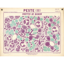 Peste (III). Frottis de bubon.