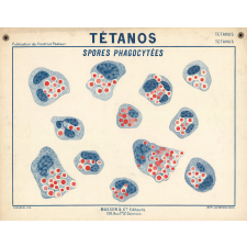 Tétanos. Spores phagocytées.