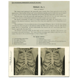 79. Wall of Thorax. The Edinburgh Stereoscopic Atlas of Anatomy. Thorax - N°3.