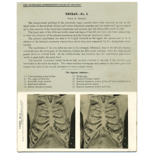 79. Wall of Thorax. The Edinburgh Stereoscopic Atlas of Anatomy. Thorax - N°3.