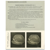 151.The greater part of the outer surface of the left Cerebral Hemisphere of an adult Male exposed in situ. The Edinburgh Stereoscopic Atlas of Anatomy. Cranio-cerebral topography - N°9.
