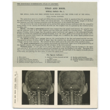 193. Dura Mater. The Edinburgh Stereoscopic Atlas of Anatomy. Head and Neck. Spinal canal - N°1.