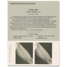 206. Inner side of Thigh. The Edinburgh Stereoscopic Atlas of Anatomy. Lower limb.Surface anatomy - N°2.