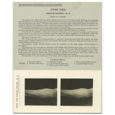 121. Front of Forearm. The Edinburgh Stereoscopic Atlas of Anatomy. Upper limb. Surface anatomy - N°4.