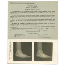 209. Outer side of Foot and Ankle. The Edinburgh Stereoscopic Atlas of Anatomy. Lower limb. Surface anatomy - N°5.