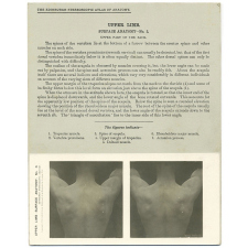 120. Shoulder from behind. The Edinburgh Stereoscopic Atlas of Anatomy. Upper Limb. Surface anatomy - N°3. Upper part of the back.