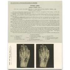 137. Palmar Arch and Flexor Tendons and Nerves. The Edinburgh Stereoscopic Atlas of Anatomy. Upper limb. Palm of Hand - N°2.