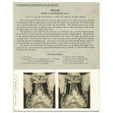 110. Back wall of the Pericardium, to show the openings for the vessels. The Edinburgh Stereoscopic Atlas of Anatomy. Thorax. Heart and Pericardium - N°10.