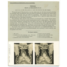 110. Back wall of the Pericardium, to show the openings for the vessels. The Edinburgh Stereoscopic Atlas of Anatomy. Thorax. Heart and Pericardium - N°10.