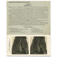 92. Interior of Thorax, after removal of the Thymus Gland, the Pericardium, and its contents, &c. The Edinburgh Stereoscopic Atlas of Anatomy. Thorax. Mediastina - N°1.