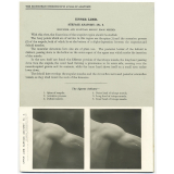 119. The Back. The Edinburgh Stereoscopic Atlas of Anatomy. Upper Limb. Surface anatomy - N°2. Shoulder and scapular region from behind.