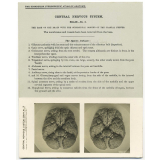 155. The base of the brain with the superficial origins of the Cranial Nerves. The Edinburgh Stereoscopic Atlas of Anatomy. Central nervous system. Brain - N°3. 