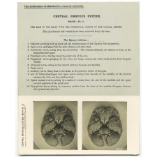 155. The base of the brain with the superficial origins of the Cranial Nerves. The Edinburgh Stereoscopic Atlas of Anatomy. Central nervous system. Brain - N°3.
