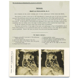 109. The interior of the right Auricle and of both Ventricles, viewed from the front. The Edinburgh Stereoscopic Atlas of Anatomy. Thorax. Heart and Pericardium - N°9.