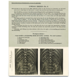 48. Posterior relations of the Kidneys. The Edinburgh Stereoscopic Atlas of Anatomy. Lumbar region - N°3. 