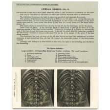 48. Posterior relations of the Kidneys. The Edinburgh Stereoscopic Atlas of Anatomy. Lumbar region - N°3. 