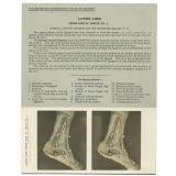 233. Internal Annular Ligament. The Edinburgh Stereoscopic Atlas of Anatomy. Lower limb. Inner side of ankle - N°1.
