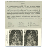 116. Roots of the Lungs, OEsophagus, Stomach, Pancreas, &c., from behind, in situ. The Edinburgh Stereoscopic Atlas of Anatomy. Thorax. Back - N°4.